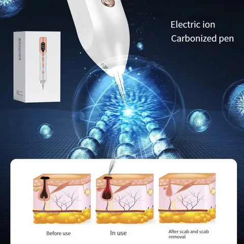 Advanced Plasma Microneedle Pen